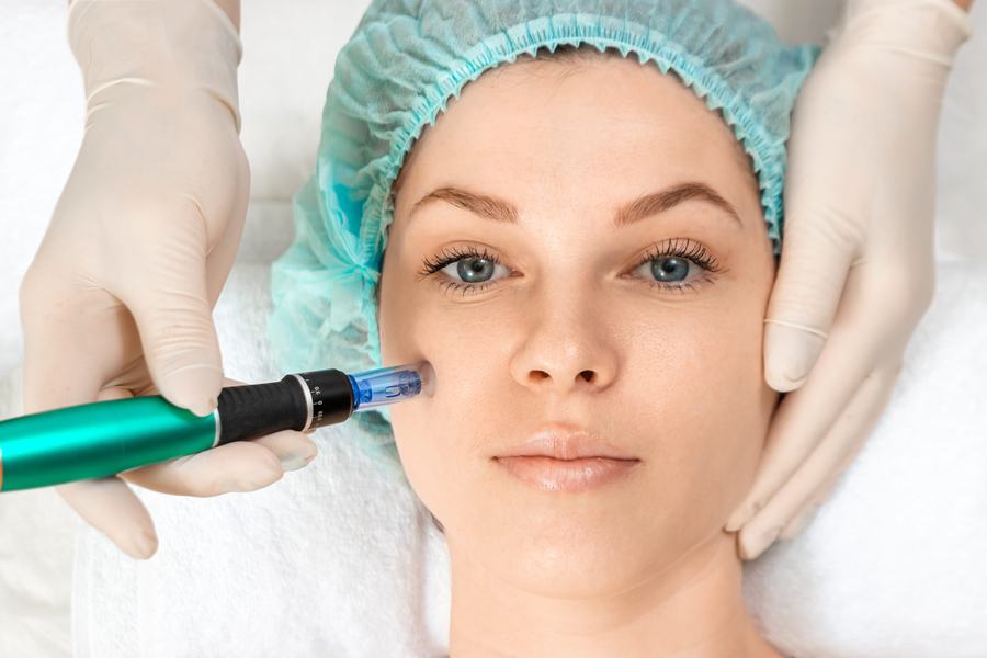 woman taking microneedling treetment for skin