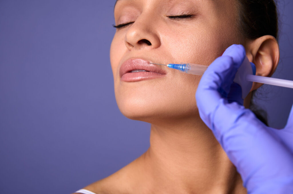 lip fillers