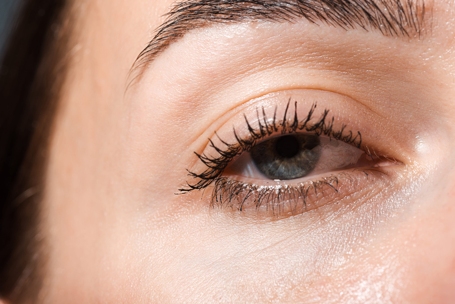 upper eyelid blepharoplasty